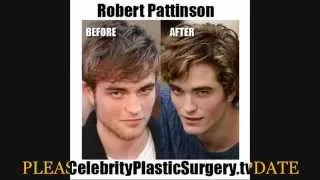 !!!Shocking Celebrities Before and After Plastic Surgery