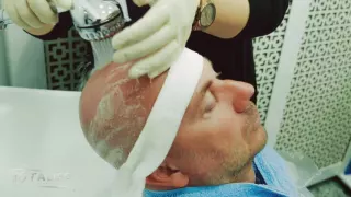 Haartransplantation in der Türkei