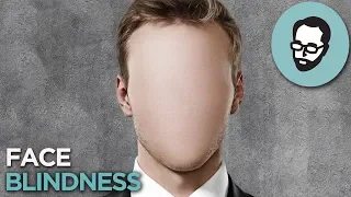 The Condition That Makes People's Faces Disappear | Random Thursday