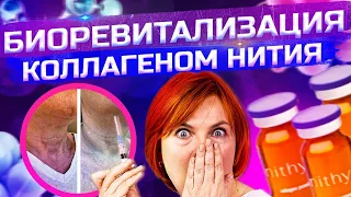 Биоревитализация коллагеном Нития (Nithya)