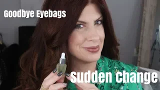 SUDDEN CHANGE REVIEW GOODBYE EYE BAGS?