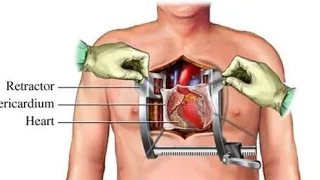 Cardiac OT setup/ equipments for open heart surgery