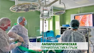 Удаление грыжи – лапароскопическая герниопластика