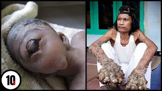 10 Most Shocking Human Mutations In The World