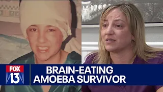 Florida woman survives brain-eating amoeba offers hope to teen
