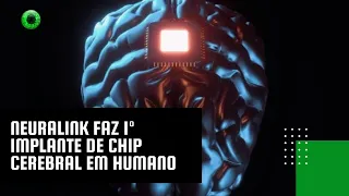 Neuralink faz 1º implante de chip cerebral em humano