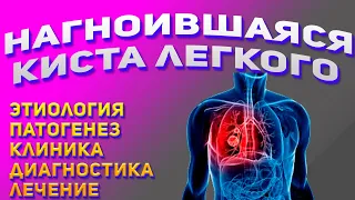 Нагноившаяся киста легкого. Причины появления кисты. Лечение кисты.