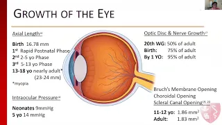 Clinical Presentation and History - Pediatric patients with ODD and mechanism of vision loss