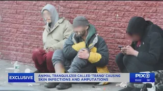 ‘Tranq’ users talk about skin-eating drug that can lead to amputation