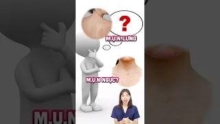 Mụn lưng và mụn ngực nguyên nhân và cách sử lý #chiasekinhnghiem