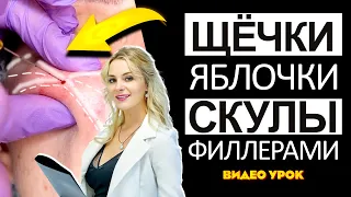 Щёчки яблочки / скулы филлерами ВИДЕО УРОК