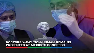 Doctors x-ray 'non-human' remains presented at Mexico's congress | ABS-CBN News