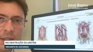 Reconstrução da Uretra - Dr. Júlio Bissoli