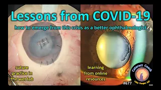 Cataract Coach lessons from COVID-19