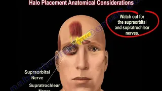 Upper & Lower cervical Spine Trauma, neck injury    Everything You Need To Know - Dr. Nabil Ebraheim