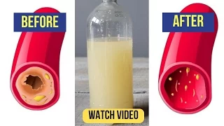 Only a Glass of This Juice will Remove Clogged Arteries And Control Blood Pressure