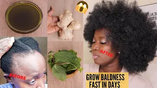 MIX GINGER & MINT LEAVES TO GROW BALDNESS ALOPECIA SLOW GROWTH 3 TIMES UNSTOPPABLE FASTER