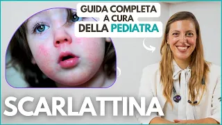 SCARLATTINA: Sintomi, diagnosi e cura