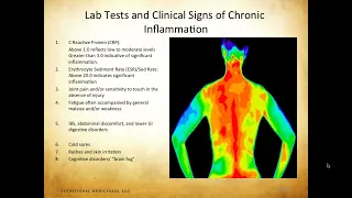 Identifying and Extinguishing Inflammation