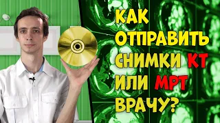 Как отправить СНИМКИ КТ или МРТ доктору 📀.