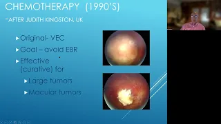 Lecture: Retinoblastoma Care and Research Updates for 2022