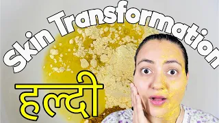 त्वचा की कितनी भी मुश्किल समस्या का 100% इलाज़ सिर्फ एक Ingredient से | Turmeric (हल्दी) for Skin💕