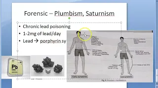 Forensic 260 a Plumbism Saturnism Chronic lead poisoning Burton Burtonian line Basophilic stippling