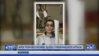 Apex teen suffered 46 injuries to face and head in machete attack