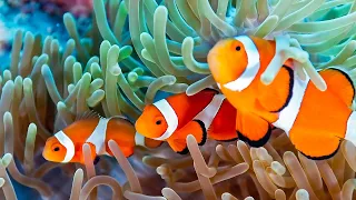Beautiful Relaxing Music to Relieve Stress, Anxiety & Depression 🐠 Mind, Body & Soul Healing