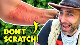 STUNG by the Scratchbush!