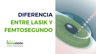 Diferencia entre Lasik y Femtosegundo