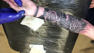 перекрытие шрамов розами