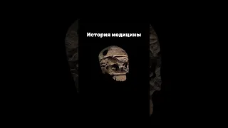 Развитие медицины 🩺 #наука #факты #youtube #shorts