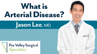 Arterial Disease with Dr. Jason Le