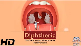 Diphtheria: The Silent Battle Against a Deadly Disease