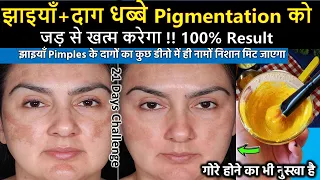 रोज 1 बार लगाए,चमकेगा चेहरा,दूर होंगे दाग धब्बे-100% Effective Homeremedy- how to treat pigmentation