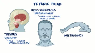 Clostridium tetani tetanus   causes, symptoms, diagnosis, treatment, pathology