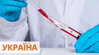 Абсолютный антирекорд: в Украине более 75 тыс. больных коронавирусом