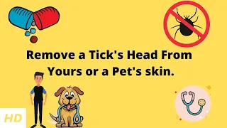 Remove a Tick's Head From Yours or a Pet's skin.