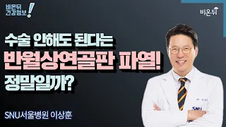 수술 안해도 된다는 반월상연골판 파열! 정말일까? | 무릎통증 |무릎 물주머니 [이상훈의 무릎] #7 / SNU서울병원 정형외과 이상훈