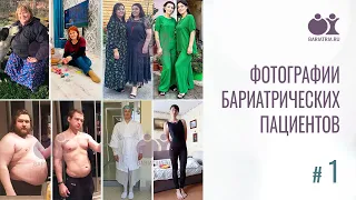 Фото бариатрических пациентов. Часть 1