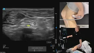 Ultrasound Evaluation of the Medial and Lateral Knee