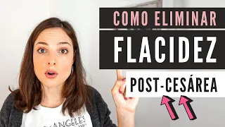 Cómo ELIMINAR la FLACIDEZ después de #CESÁREA 🔥3 PASOS para acabar con ella 🙅‍♀️