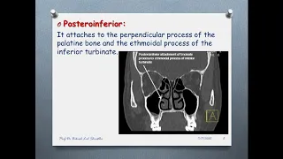 ALL ABOUT UNCINATE PROCESS of SINONASAL REGION.