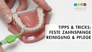 FESTE ZAHNSPANGE  – Tipps & Tricks zur Reinigung und Pflege