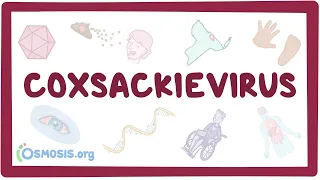 Coxsackievirus - an Osmosis Preview