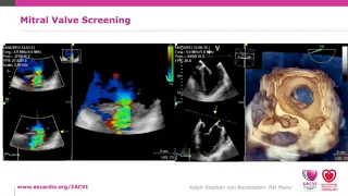 EACVI free webinar: How to use TOE for interventional procedures: tips and tricks