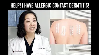 Do You Have Allergic Contact Dermatitis? | Julia Ro, PA-C know what to do.