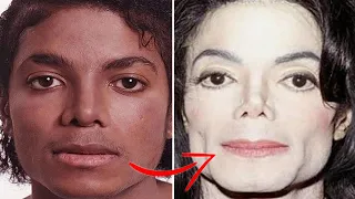 Reasons Why Michael Jackson Changed His Skin Color