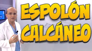 ESPOLÓN CALCÁNEO - Todo lo que necesita saber